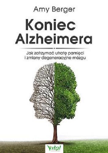 Okładka książki Koniec Alzheimera : jak zatrzymać utratę pamięci i zmiany degeneracyjne mózgu / Amy Berger ; [tłumaczenie Anna Jurga ; przedmowa David Perlmutter].
